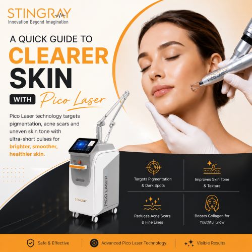 A Quick Guide to Clearer Skin With Pico Laser